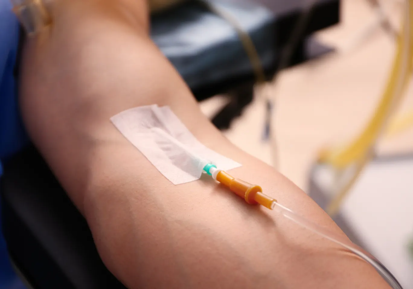 Kroplówki witaminowe Luboń: przedramię z kaniulą i przezroczystym opatrunkiem